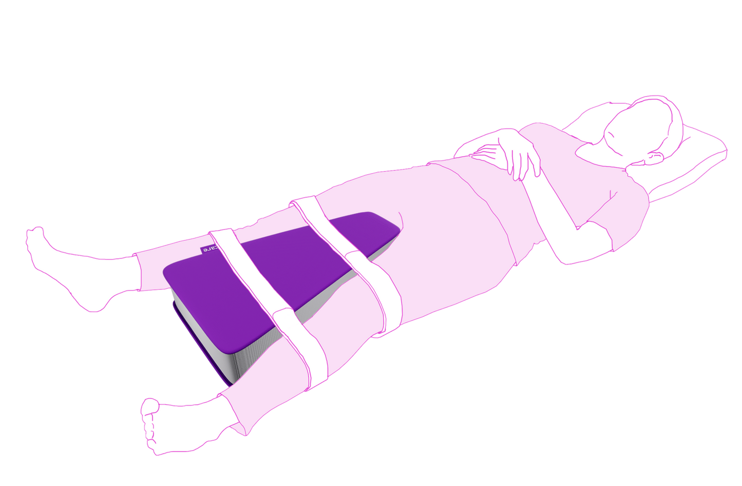 Diagram of a person lying on their side with a purple icare Supporta Hip Abductor Cushion